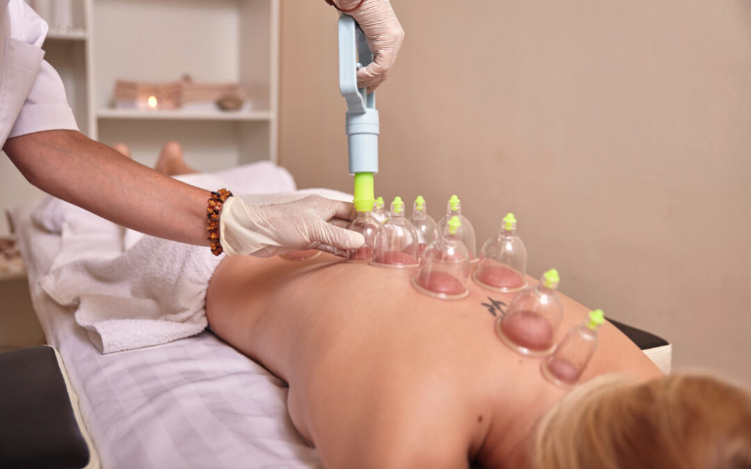 Top 10 benefits of cupping massage therapy