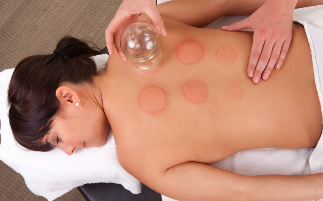Cupping Therapy: The Surprising Solution to Your Chronic Pain and Inflammation